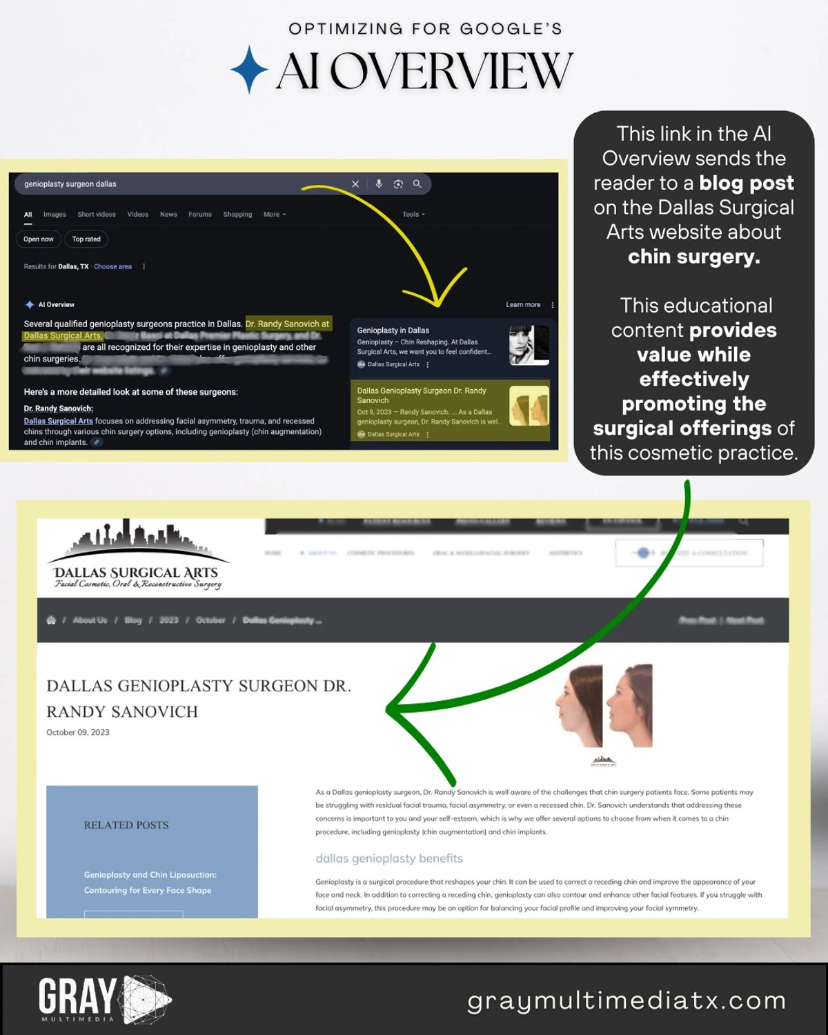 Infographic about Google AI Overview optimization for Dallas Surgical Arts