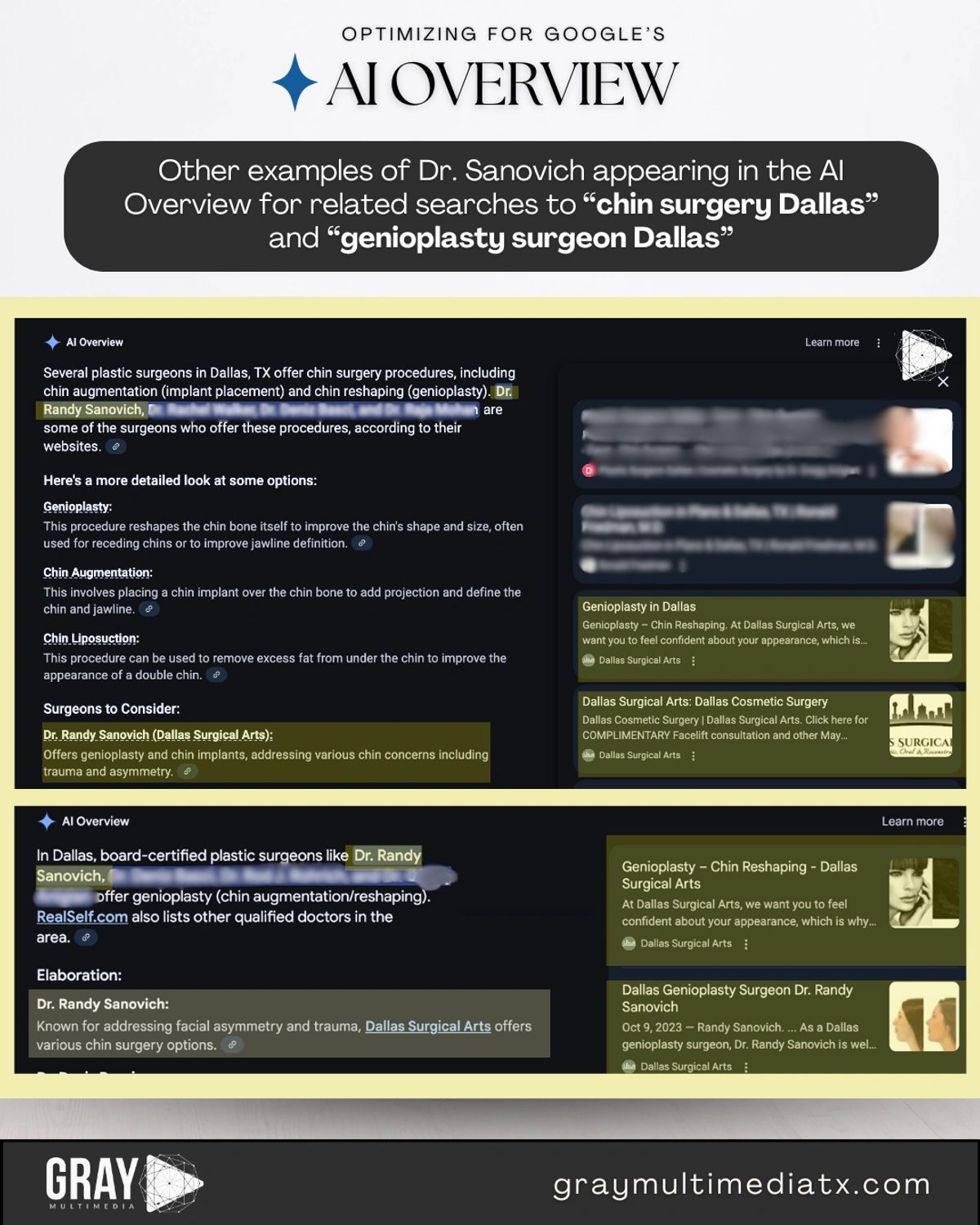 Dr. Randy Sanovich in an AI Overview for Dallas chin surgery and genioplasty